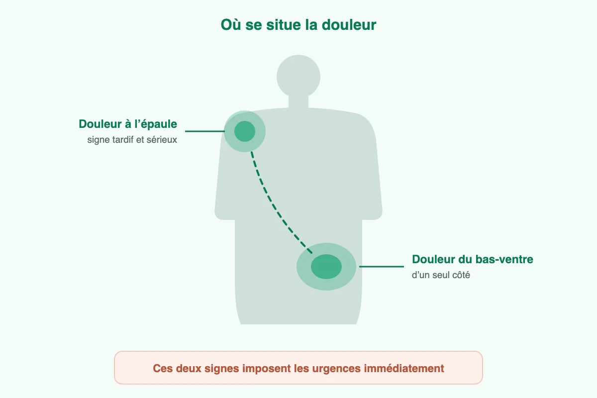 Grossesse extra-utérine : localisation de la douleur au bas-ventre et à l’épaule